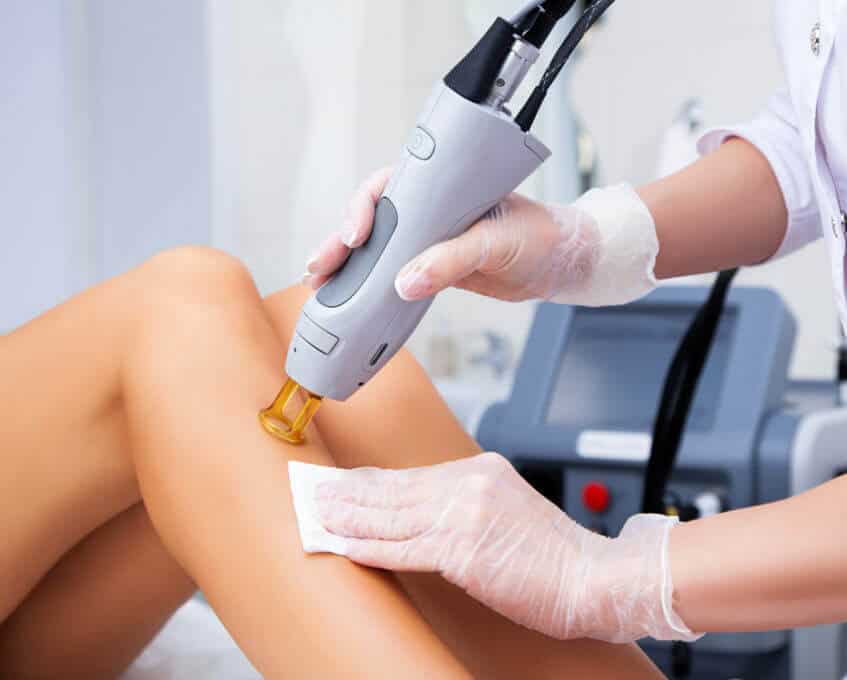 Woman Getting Laser Hair Removal Treatment on her Legs | Essence Med Spa in Grand Island & Hastings, NE