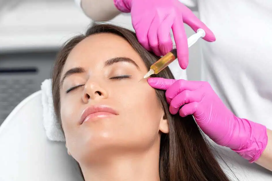 Chemical Peel Treatment