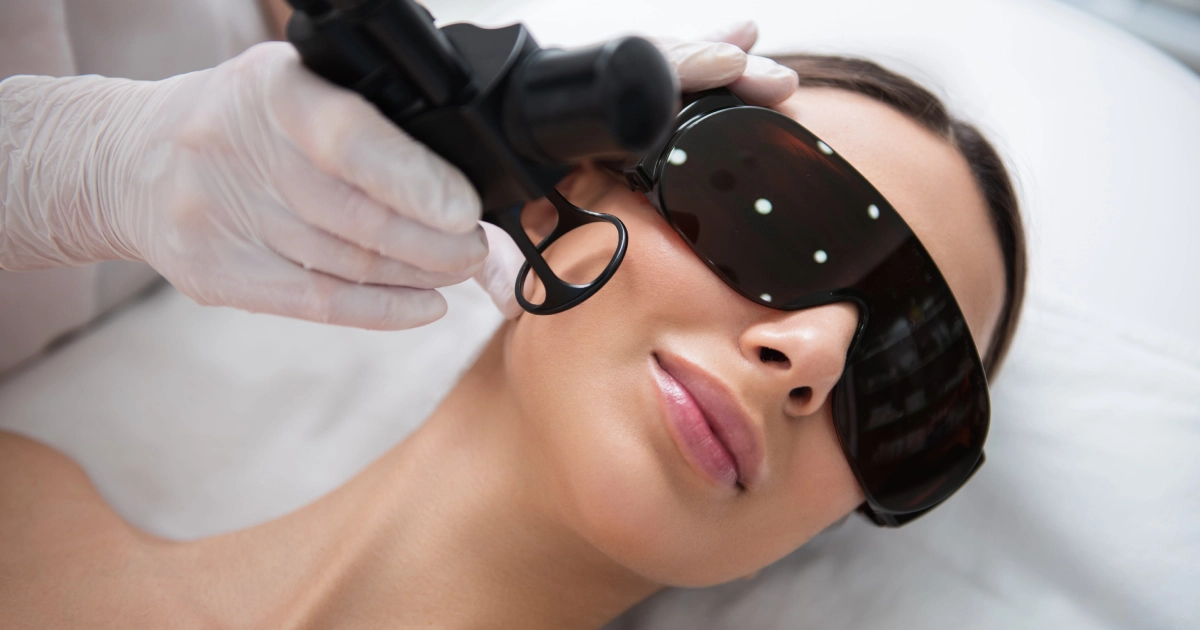 A woman receives a ProFractional laser facial in Hastings, NE, wearing protective eye shields.