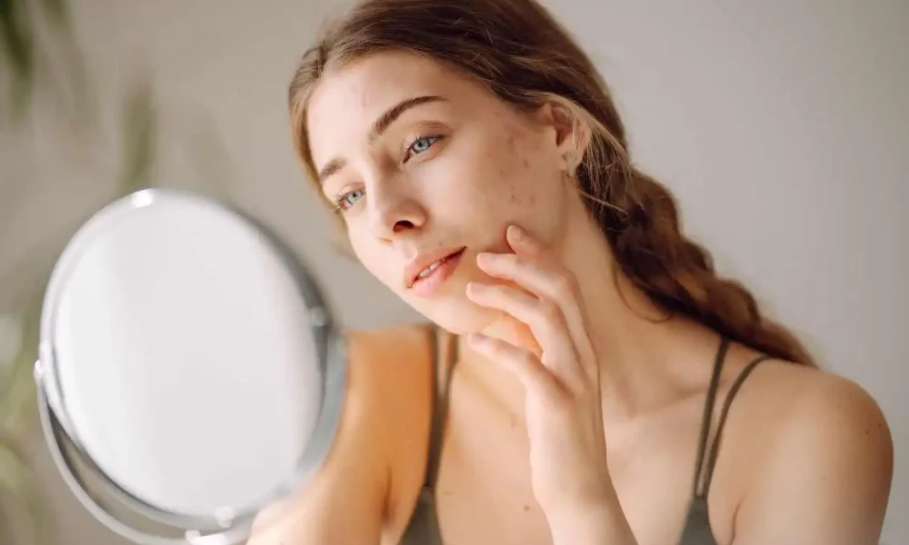 Young woman inspecting acne and blemishes on her cheek while looking in a mirror