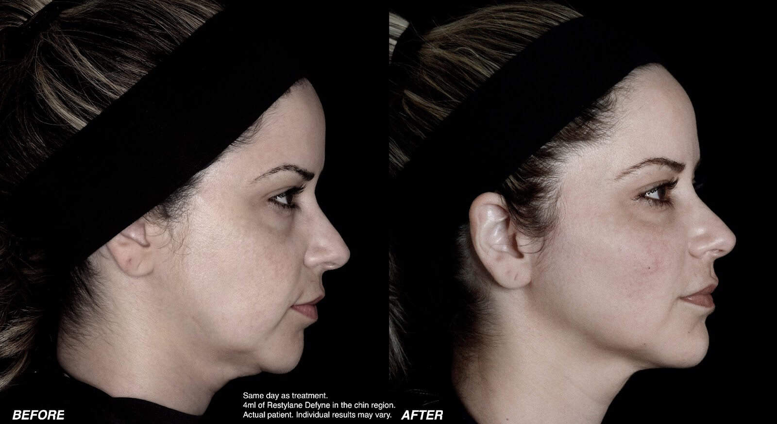 Angelita B&A FINAL
