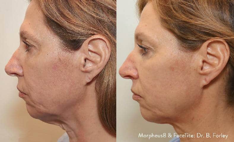 essencemedspm801 (1)