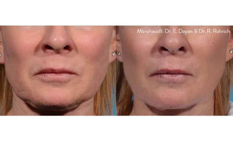 essencemedspm801 (3)